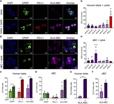 Protecting Stem Cell Derived Pancreatic Beta-Like Cells From Diabetogenic T Cell Recognition